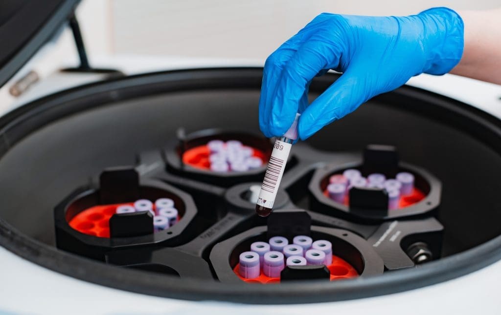 Blood sample being loaded into centrifuge