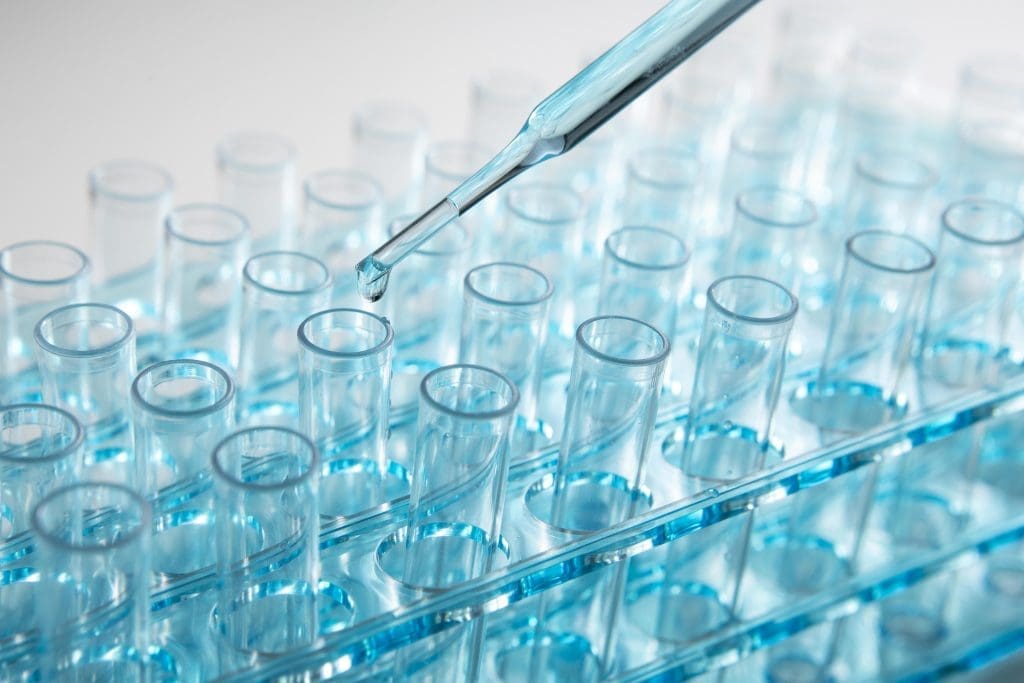 test tube diagnostic testing